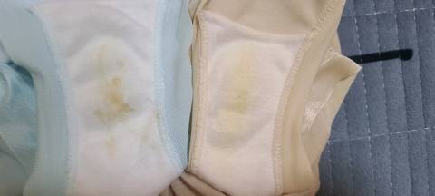 左边是今天的,右边是昨天的,之前内裤的分泌物都是昨天的颜色样子