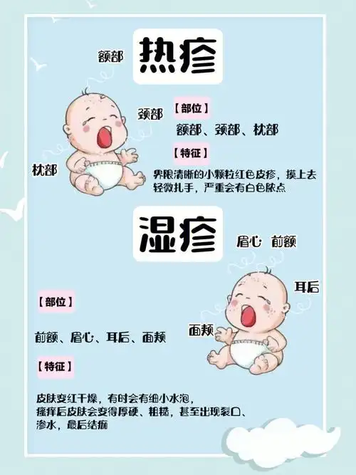 教你区分宝宝湿疹与热疹及预防治疗全攻略