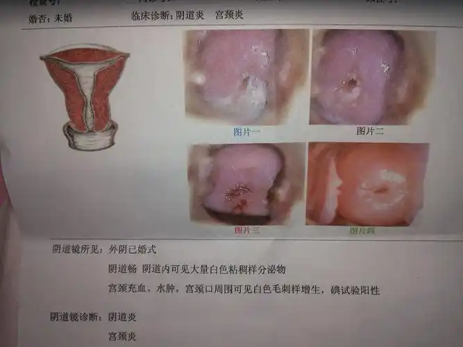 昨天跟男朋友做爱出血了我很担心然后下午