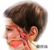 打呼噜3个月,腺样体肥大四分之三 扁桃体二度肿大  最近有很多腺样体