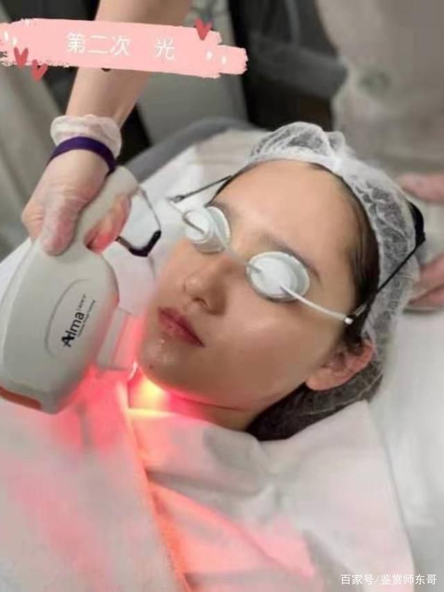 m22光子嫩肤避坑全攻略!