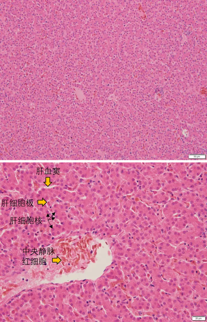 肝脏2组织病理变化综上所述,肝脏大体和显微病变的形态学观察和描述