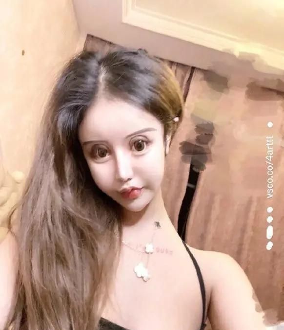 16岁网红小z娜娜3年整容超60次突破人类极限只为变真人芭比