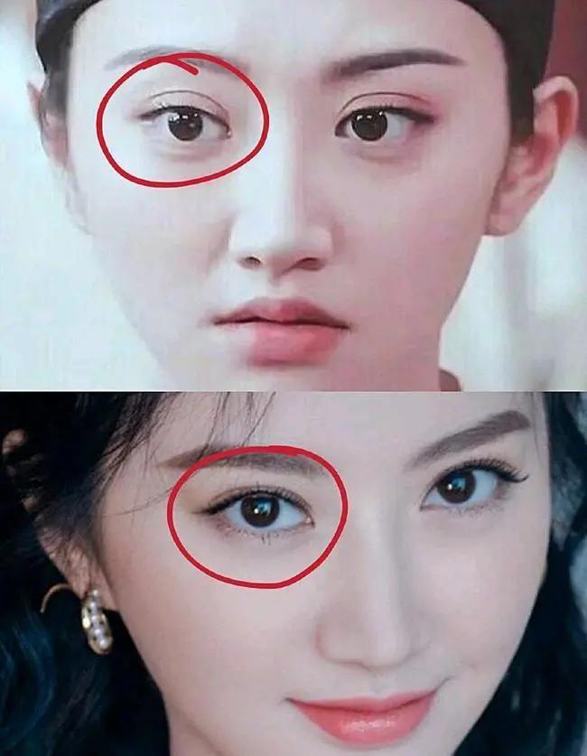 也只有景甜了,全国网友都希望景甜修复双眼皮.