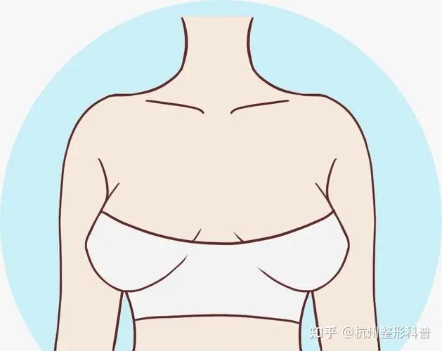 胸部外扩的原因是什么?如何矫正扩胸?_千颜网