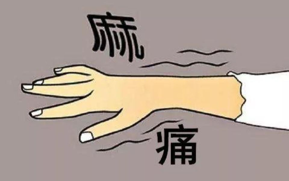 手麻,手痛,无力,你可能得的不是颈椎病和腕管综合征,而是