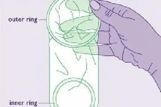 女用避孕套的使用方法