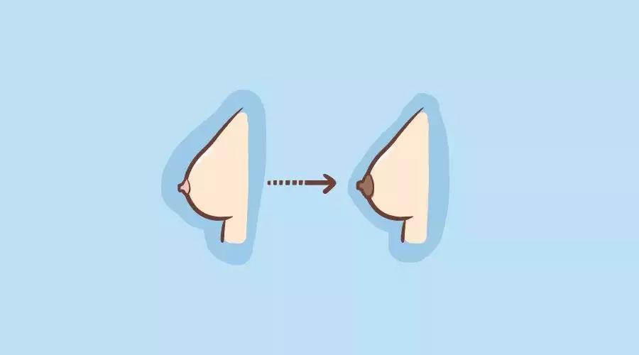 百呵育儿怀孕之后乳房的这些变化都正常吗