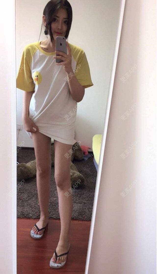 小小美啊的吸脂瘦大腿日记