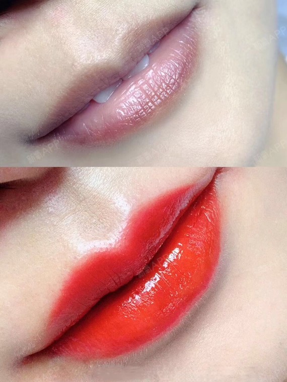 氧气zyraj半永久纹唇第0天美丽日记