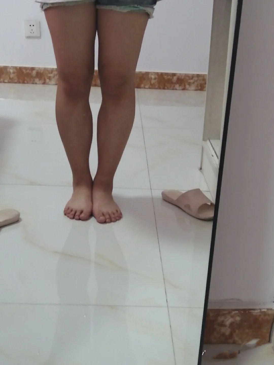 作为曾经大腿围58厘米小腿围50厘米现在我的大腿围是40厘米小腿围是