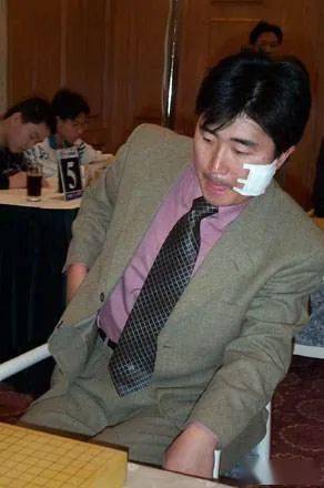 令围棋尴尬的n个瞬间——小林觉事件