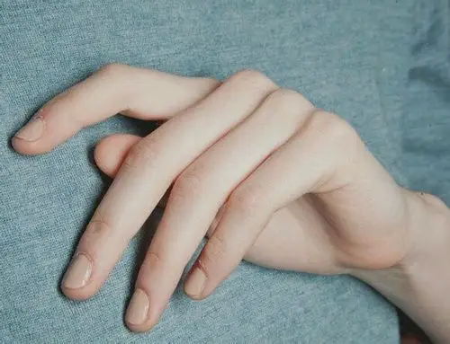 求问,手好看的人是不是长的也好看?