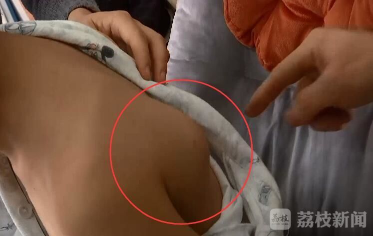 帮帮他!海安11岁男孩身患骨母细胞瘤 最大心愿是想上学