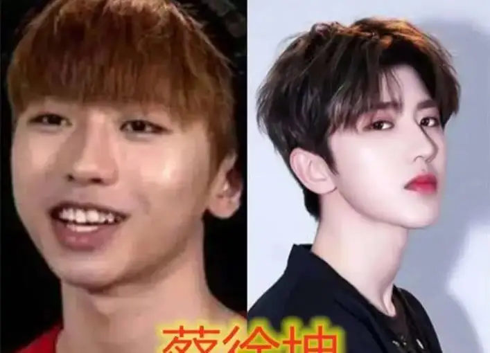 8位改头换命的男明星王一博脸已僵硬刘恺威眼皮才是灵魂