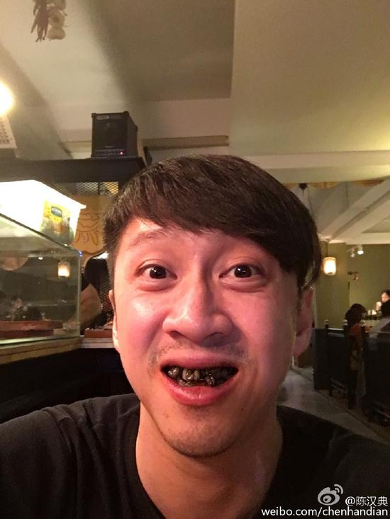 陈汉典洗牙后晒自黑自拍满口黑牙扮丑