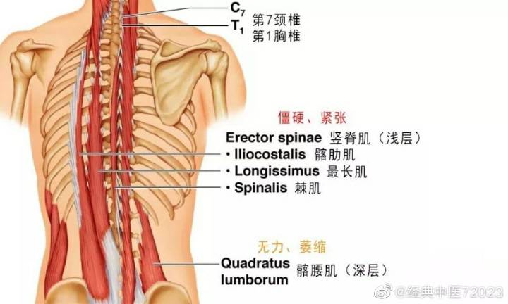 腰肌劳损到底是腰部的哪些肌肉劳损了?