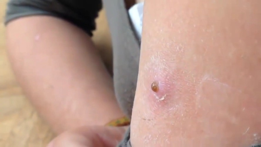 知道蛆虫哪来的吗?看完保证你不再"躺平"!_尸体_寄生_老人