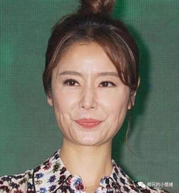 43岁林心如近照曝光,满脸横肉尽显老态,网友:委屈霍建华了__凤凰网