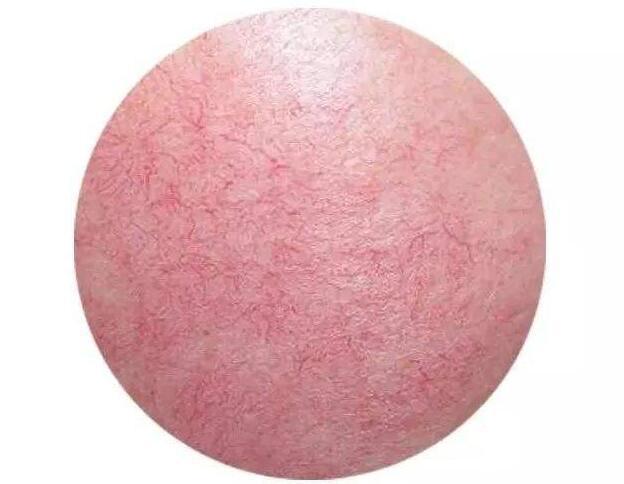 角质层薄和干性肌肤什么关系?这三种关系分析