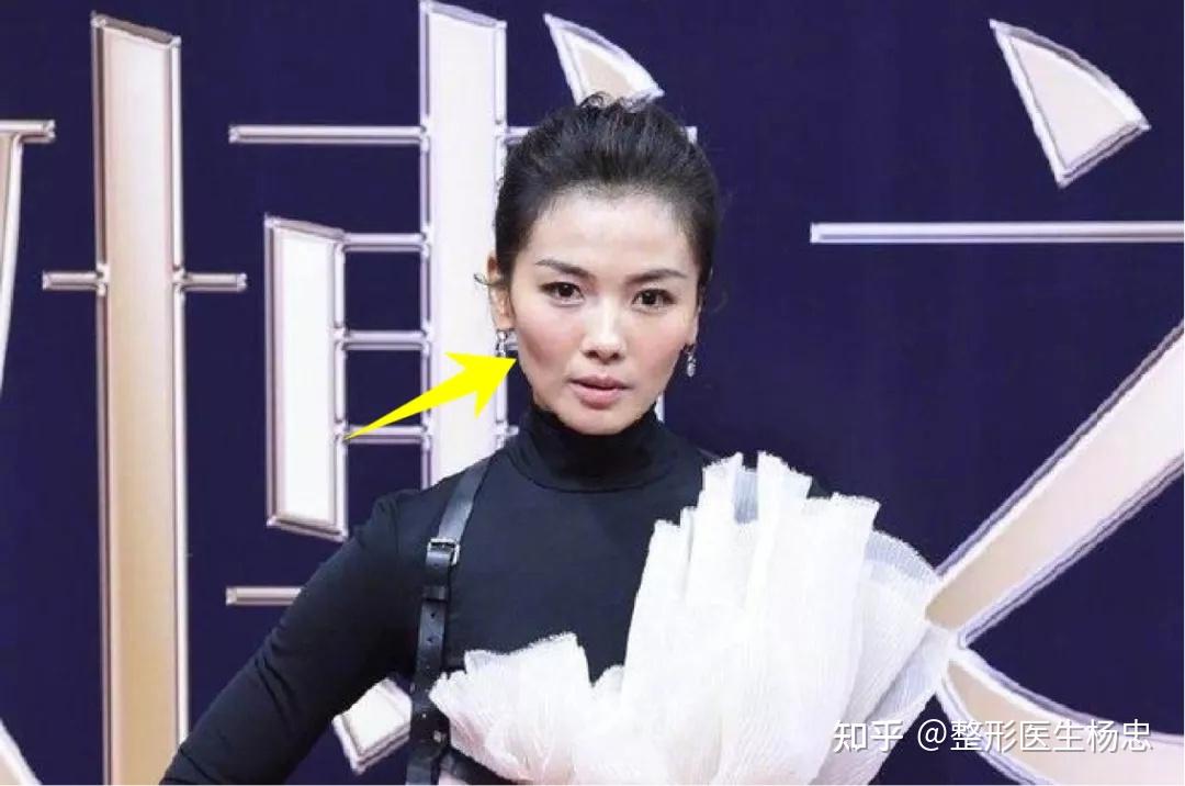 为什么刘涛的脸忽然就陷下去了