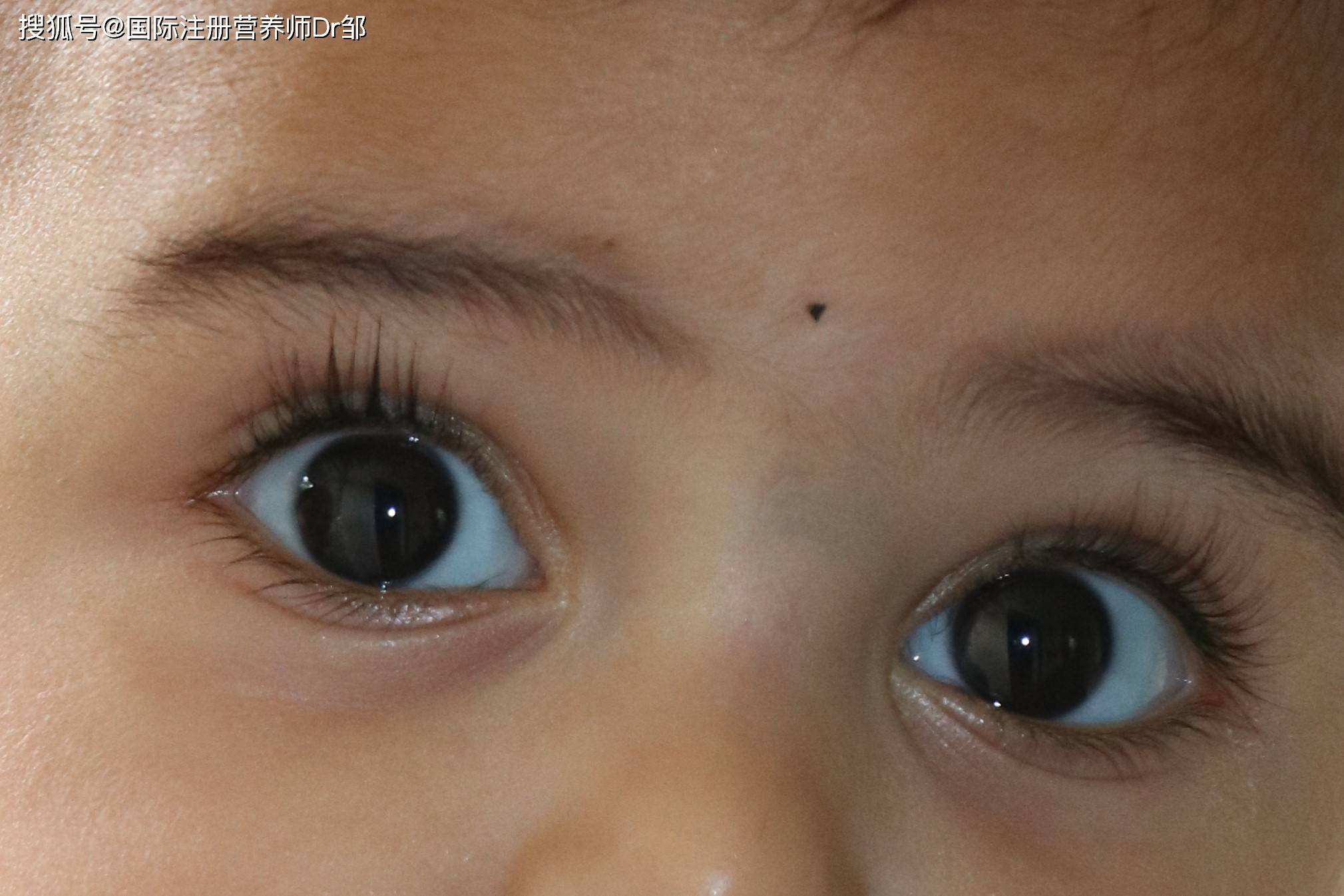 宝宝眼白发蓝,日常饮食这样优化!_功能_巩膜_蓝色