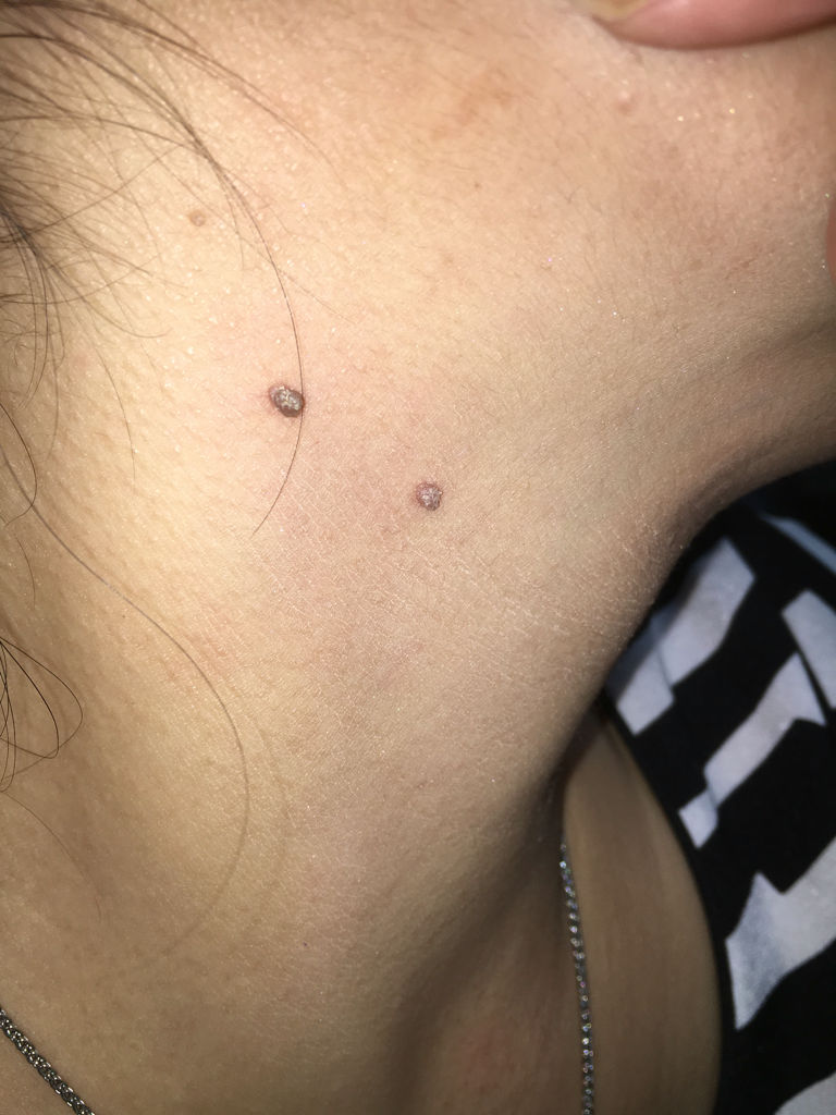 脖子上长了这个东西市什么?