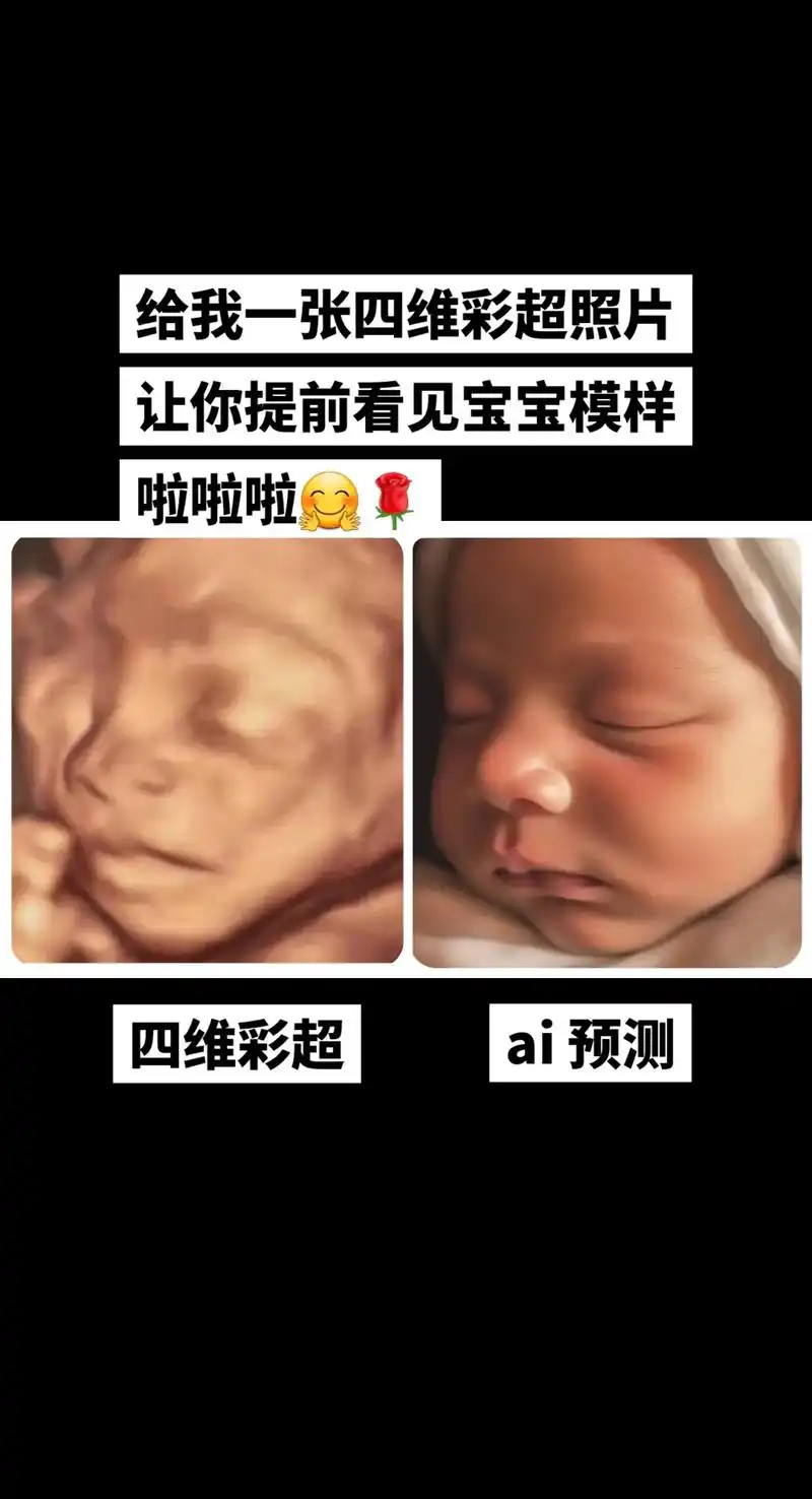 四维彩超照片 提前看见宝宝模样.