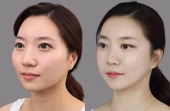 西安画美医疗美容医院-想变白,做好这件事很重要