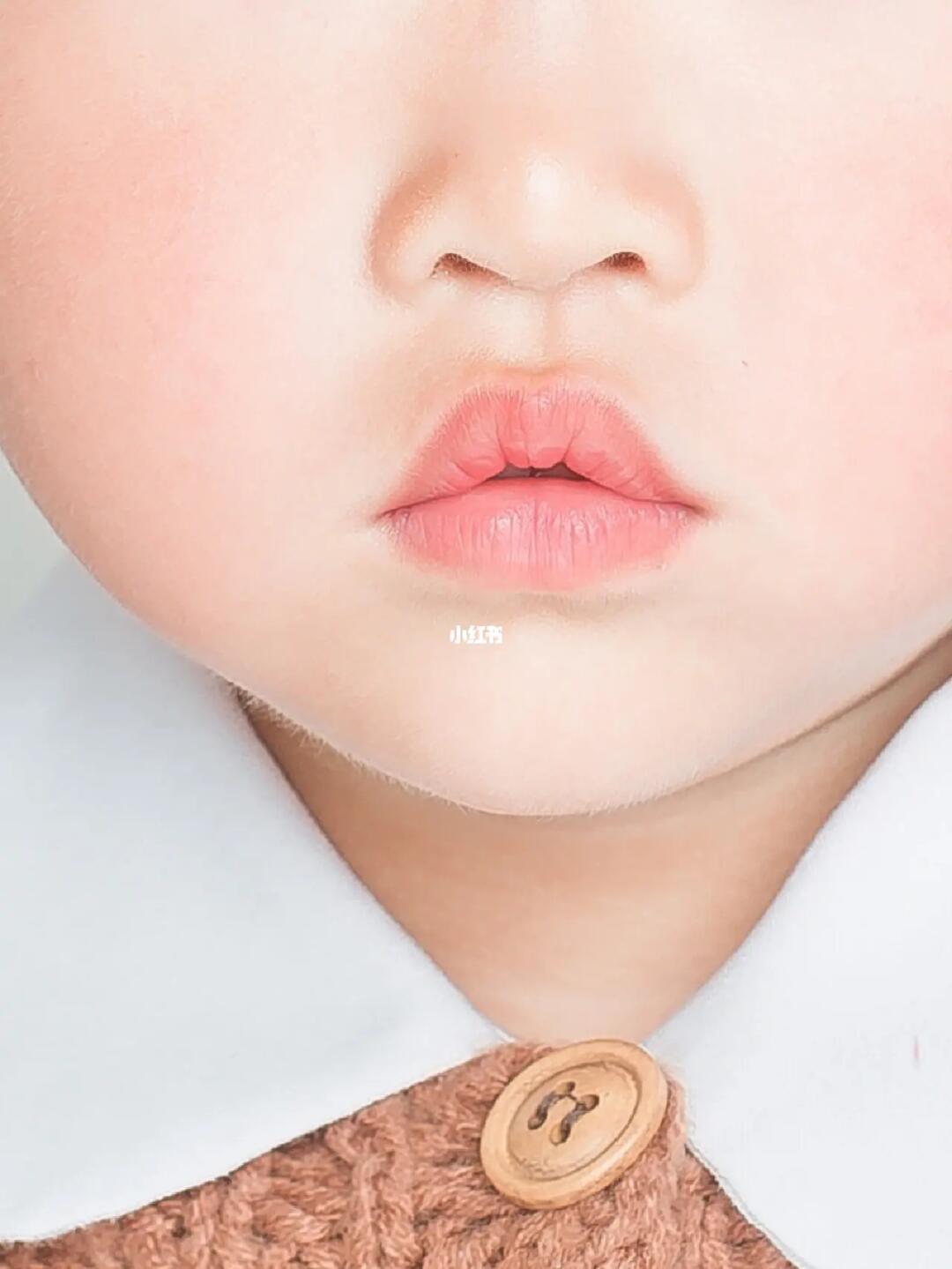 这是腺样体面容的嘴唇嘛