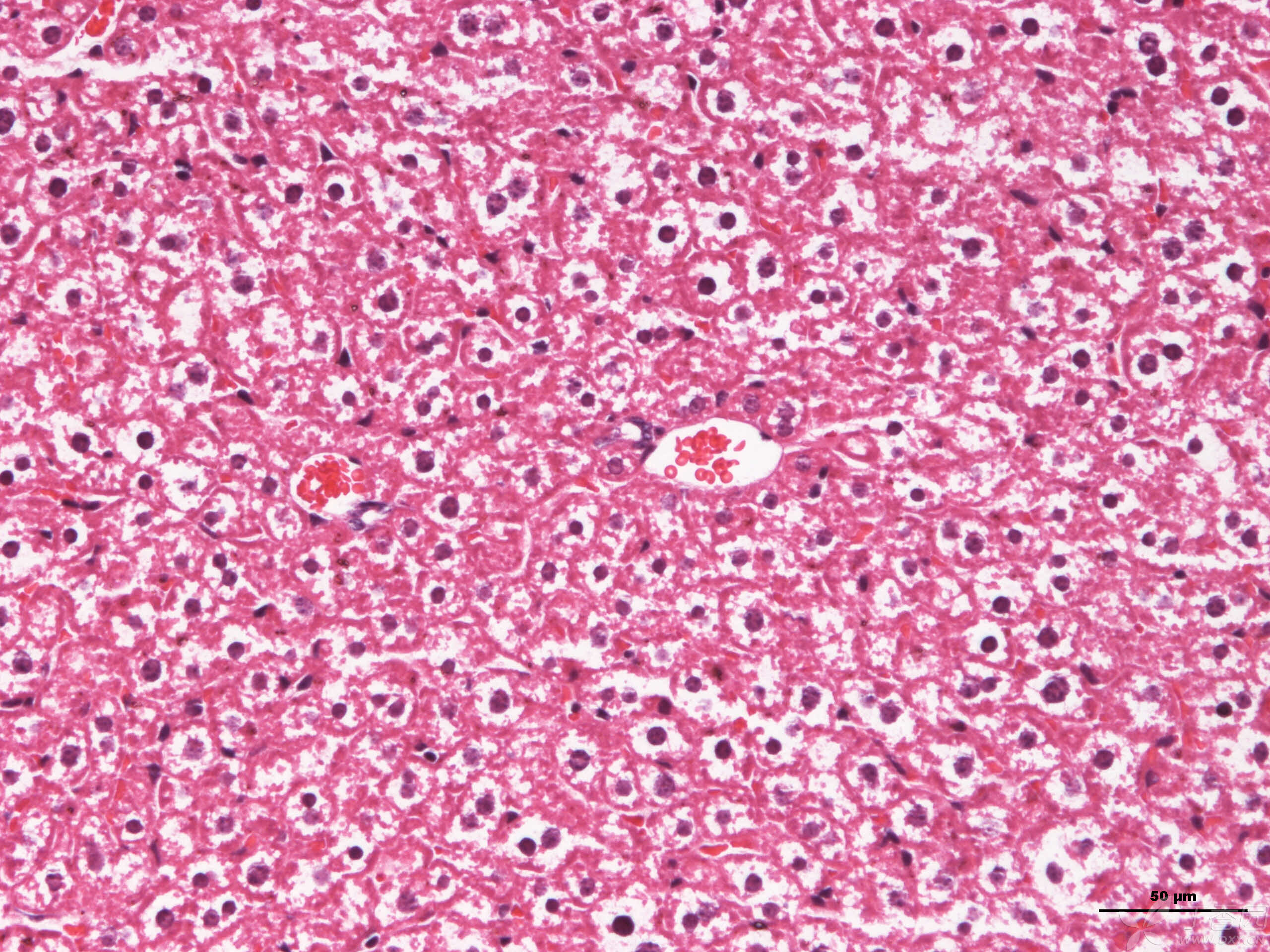 小鼠肝h&e染色图片,这些白色是脂肪变性或细胞肿胀吗?