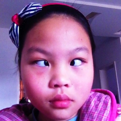 斗鸡眼图片 (29)