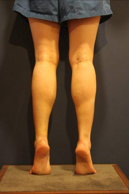 女生肌肉腿简直不忍直视,教你几招怎么瘦