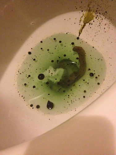 今天大便拉出很多墨绿色的油,是什么原因?