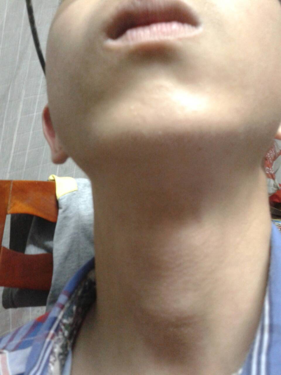 请问我有喉结了吗?我16岁了