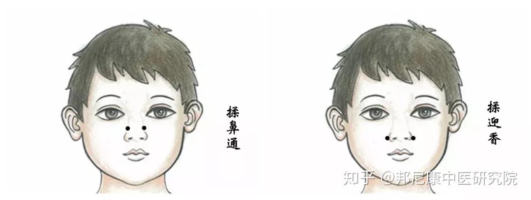 孩子鼻甲肥大,腺样体肥大,上颌窦炎全都有!