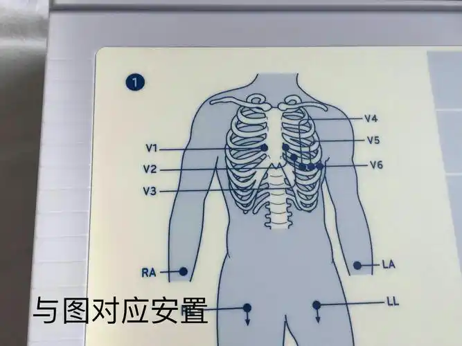 心电图机的使用――肝病三四科