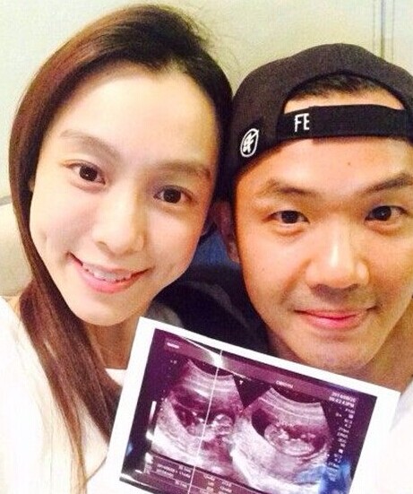 范玮琪晒b超图喜怀双胞胎.