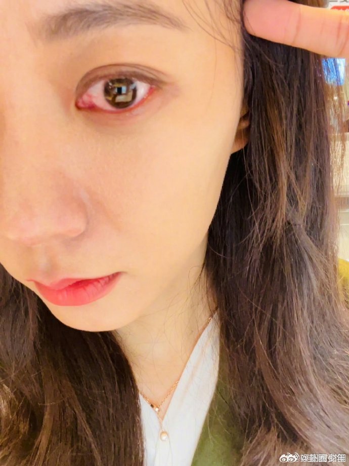 王珞丹眼睛都哭红了