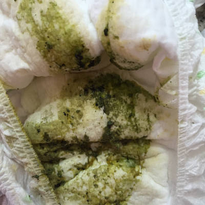 四个月宝宝,拉肚子十二天,吃了蒙脱石散和布拉氏酵母菌散还是拉,有