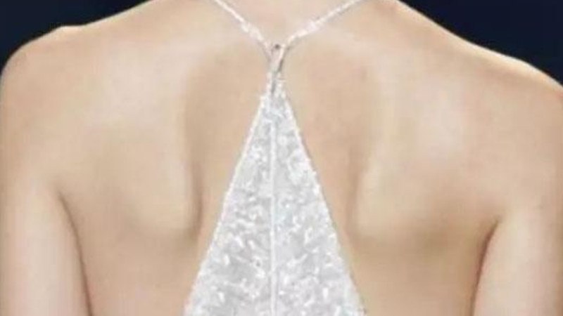 琵琶骨和蝴蝶骨的区别