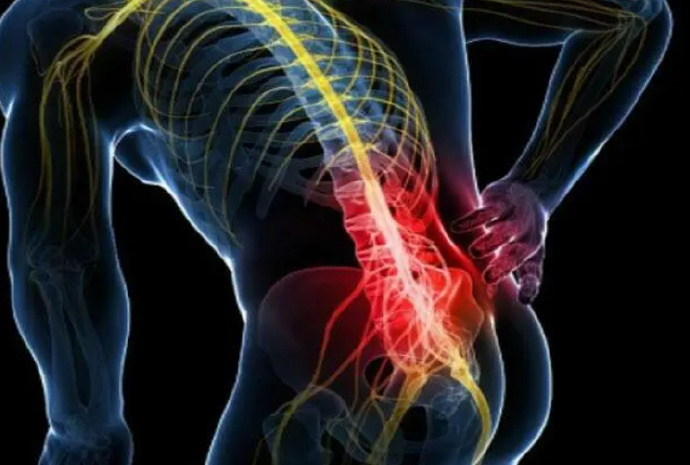 #腰椎间盘突出#