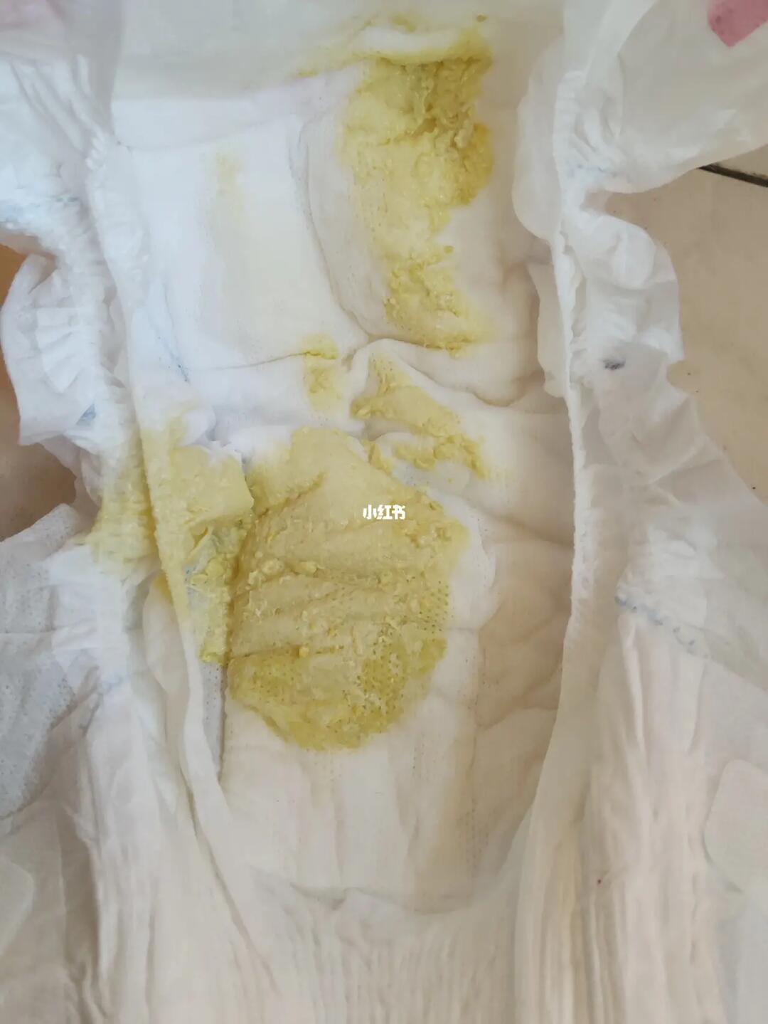 突然拉屎次数增多,是这个浅黄色偏白的,后一次就稀了,有没有知道这是