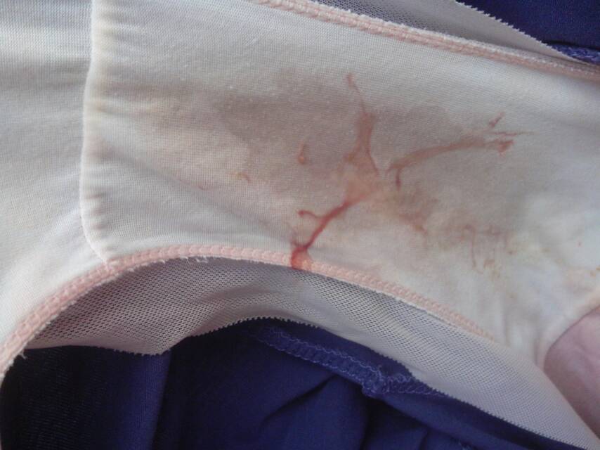 我月经过去了,白带里这样是怎么回事