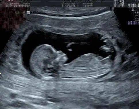 41岁的selina怀孕,b超透露胎儿性别,而比她大7岁男友却态度冷淡_孩子