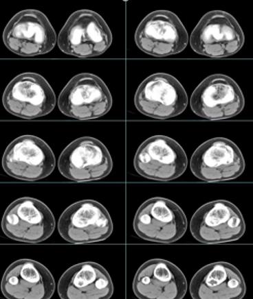 x光片ctb超核磁共振别傻傻的分不清医生告诉你