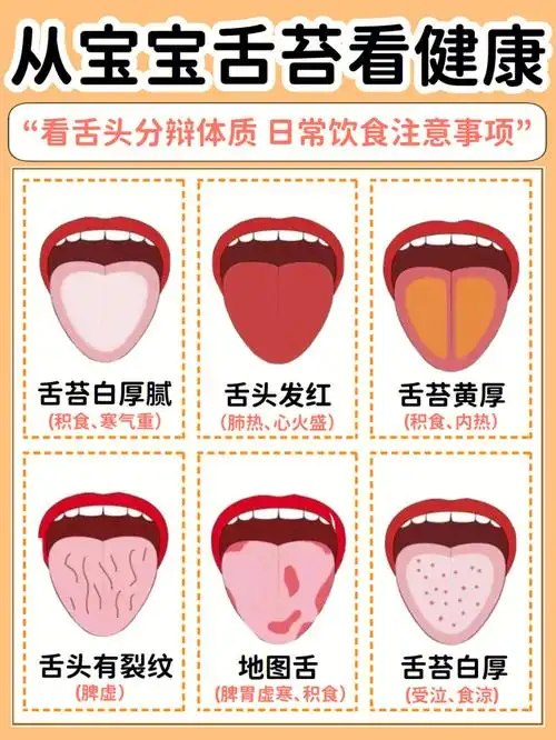 提前告诉你很多事情,新手爸妈一定要学会6015-93症状1:舌苔黏厚