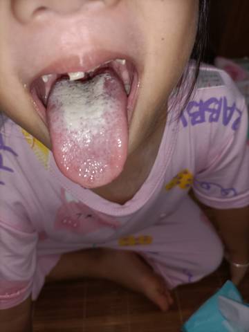 不爱吃饭,舌苔发白,4岁孩子怎么调理