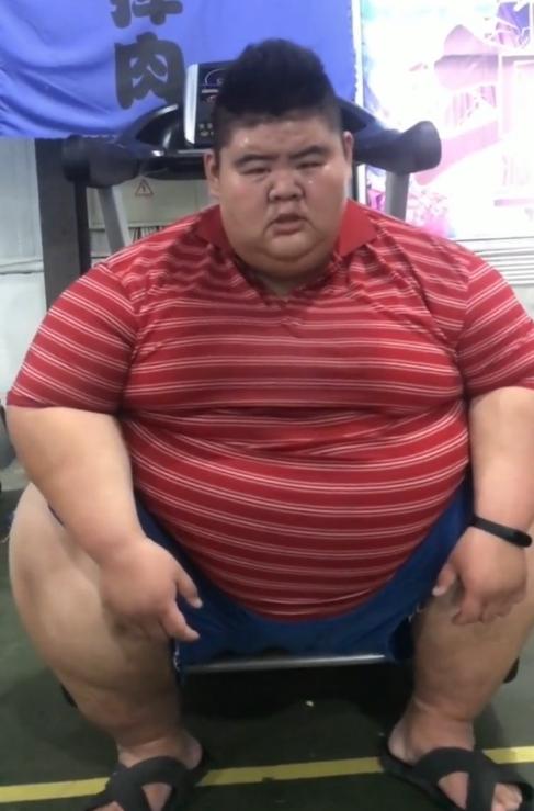 中国第一胖体重反弹皮肤松弛老态尽显网友准备二次手术