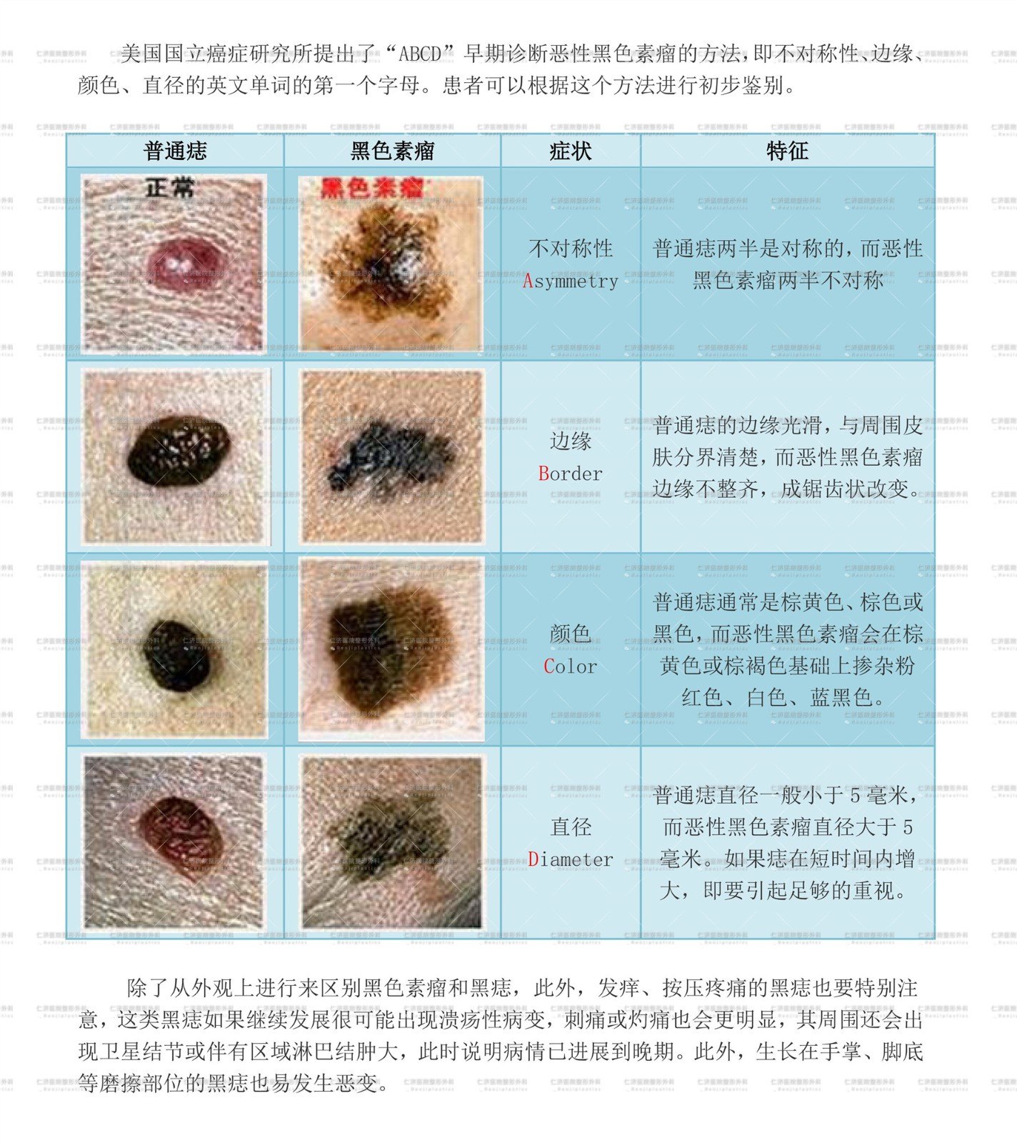 优势!黑色素瘤早期症状图片"千里迢迢"-第2张图片-普贤博客